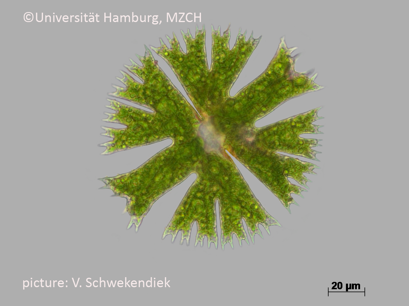 71_Micrasterias papillifera_400x_ST_2c_V.Schwekendiek.bmp